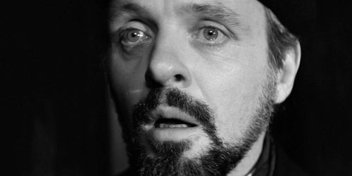 'The Elephant Man' Getting a Remake from Jack Huston